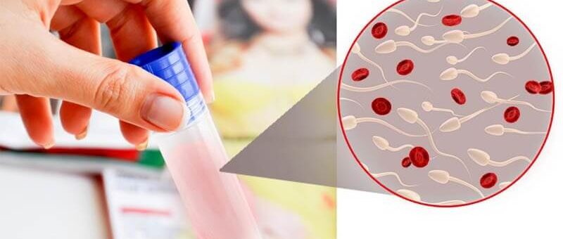 តើឈាមនៅក្នុងទឹកកាមគឺជាអ្វី?