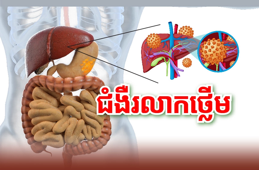 ជំងឺរលាកថ្លើម