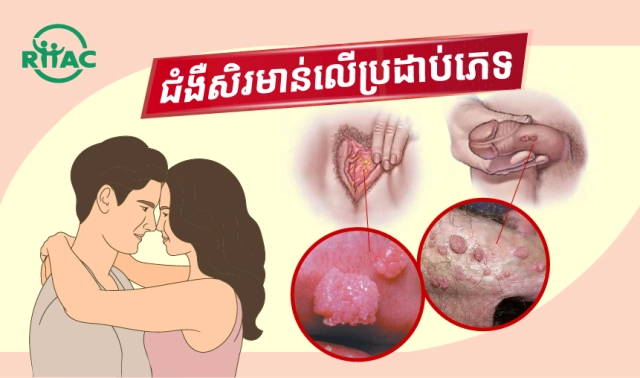 ជំងឺសិរមាន់លើប្រដាប់ភេទ