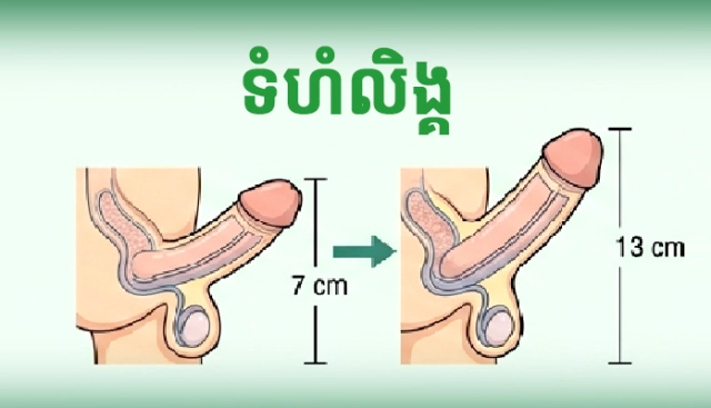 ទំហំលិង្គមាន​ភាព​ខុស​គ្នា​យ៉ាងដូចម្តេចខ្លះ?